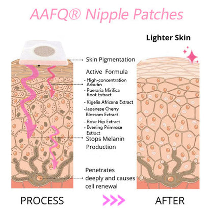 AAFQ® 𝐏𝐥𝐮𝐦𝐩 𝐮𝐩 & Tighten Skin & Soft & 𝐏𝐢𝐧𝐤𝐢𝐟𝐲 𝐍𝐢𝐩𝐩𝐥𝐞 Patches